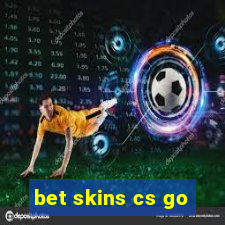 bet skins cs go