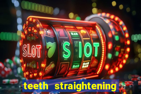 teeth straightening los altos