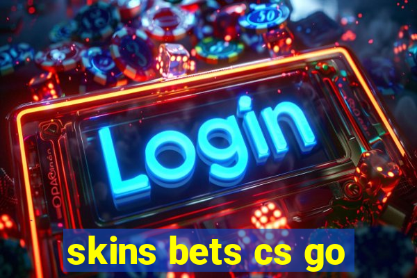 skins bets cs go